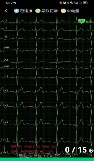 心电一张网截图2
