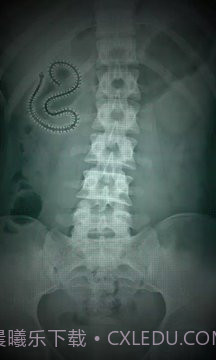 X射线扫描器胃截图6