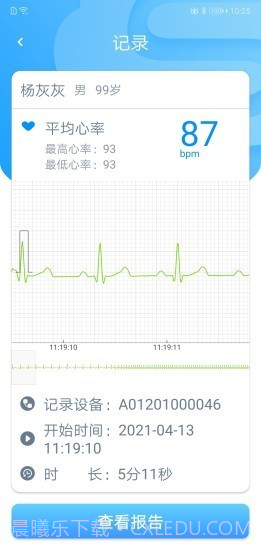 星康心电截图3 星康心电截图3