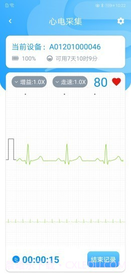 星康心电截图1 星康心电截图1