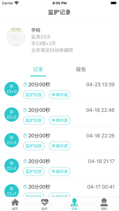 胎心监护截图3 胎心监护截图3