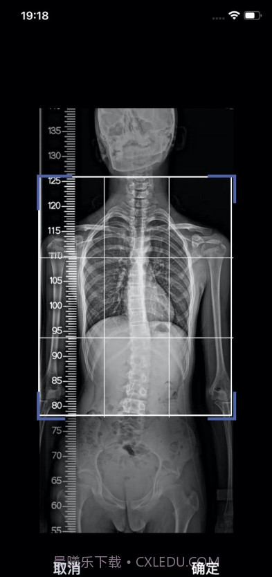 筠成矫形截图4 筠成矫形截图4