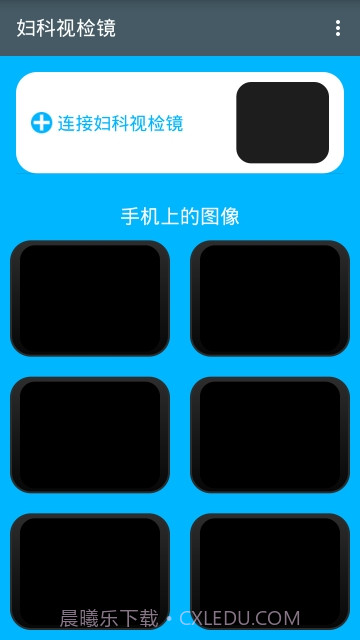 妇科视检镜截图1