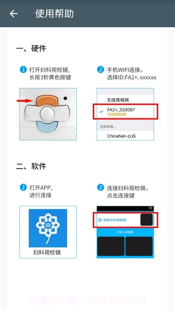 妇科视检镜截图2