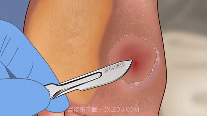 修脚足疔模拟器单机版截图3