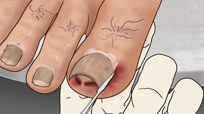 修脚足疔模拟器单机版截图1