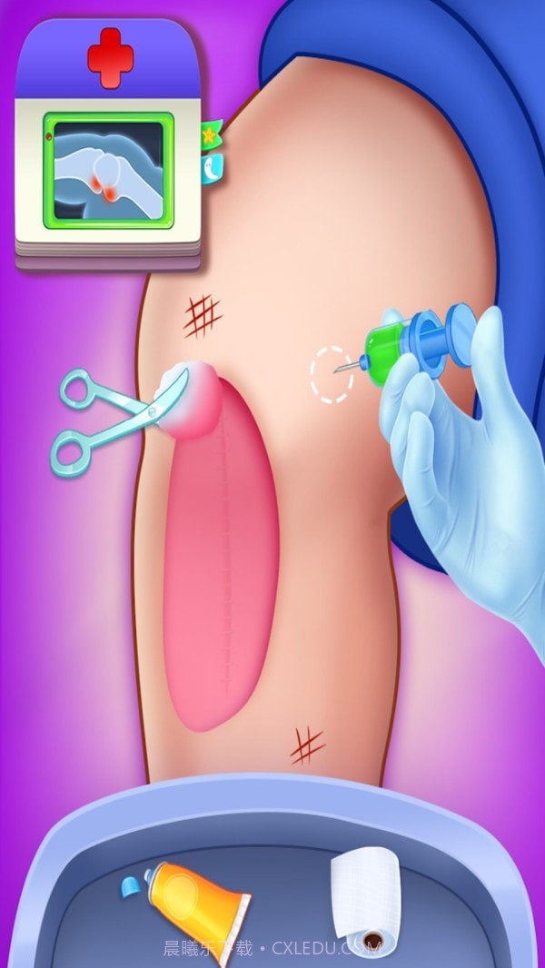 外科人体手术截图4 外科人体手术截图4